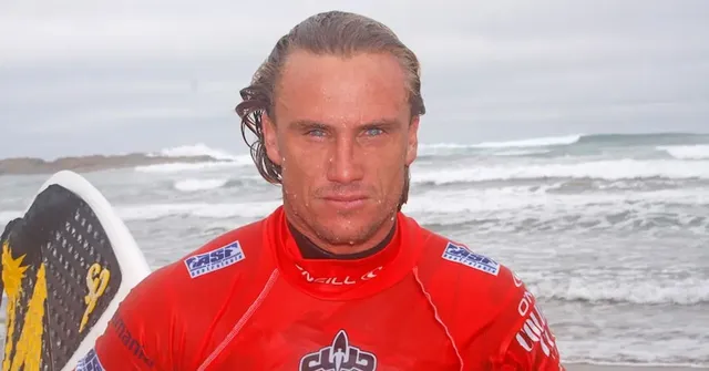 Man faces court over alleged one-punch attack of former surfing champion